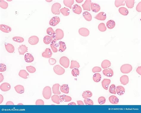  Babesia A Tiny Terror Spreading Through Bloodstreams! 